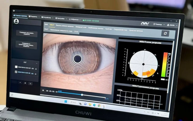 В глазную больницу поступили инновационные щелевые лампы для диагностики сухого глаза