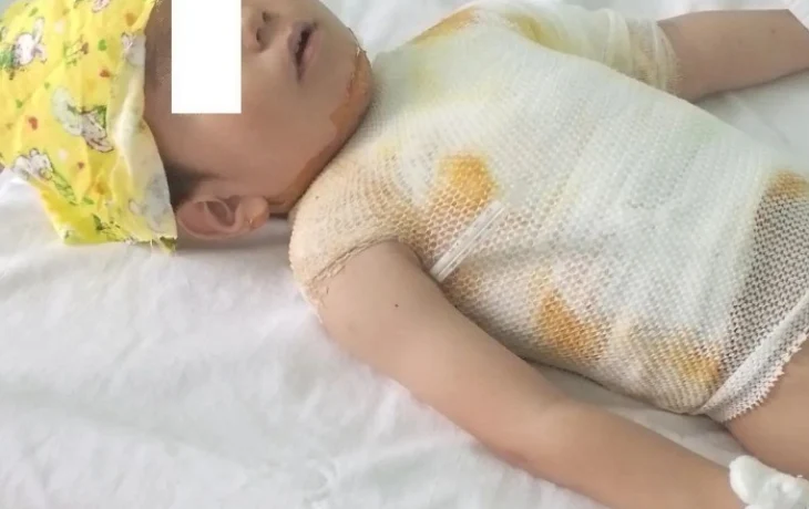 Родителей школьника-пиромана, поджегшего мальчика на детской площадке, оштрафовали на три миллиона рублей