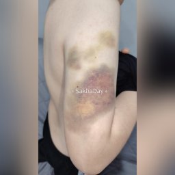 Опасная игра школьников: проиграл — получи удар по руке