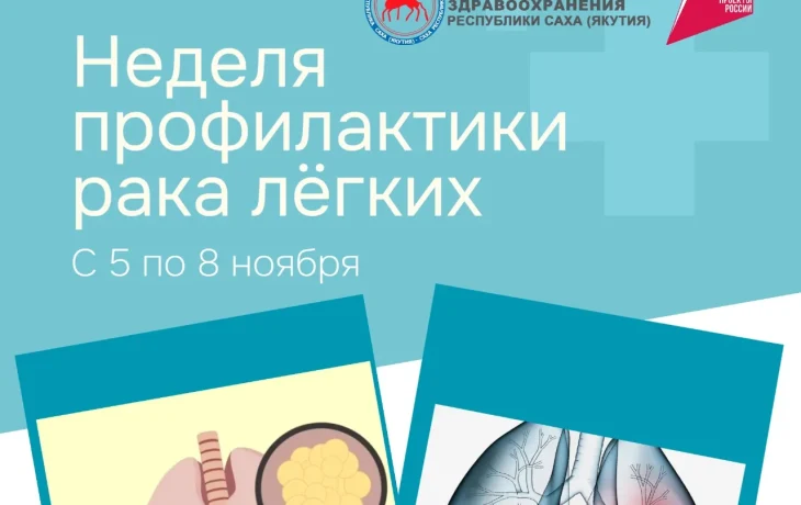 Онкологи Якутии напоминают о важности ранней диагностики рака лёгких