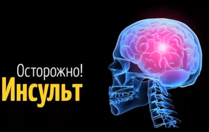 Как&nbsp;избежать катастрофы: 4 признака инсульта&nbsp;&mdash; важно вовремя их&nbsp;заметить