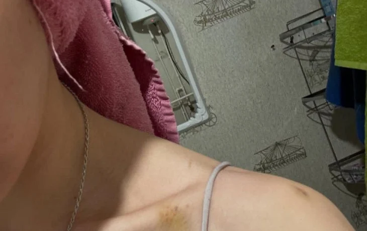 &laquo;Мое молчание &mdash; твоя свобода&raquo;: Девушка рассказала о годах насилия и преследовании бывшего партнёра