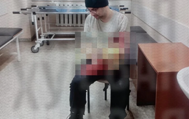 В Одессе мужчина тяжело травмировал себя болгаркой, пытаясь избежать отправки в ВСУ &mdash; соцсети