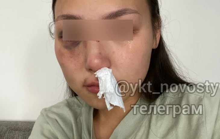 Якутянка обвинила сотрудника МЧС в избиении и домогательствах к 16-летней сестре: